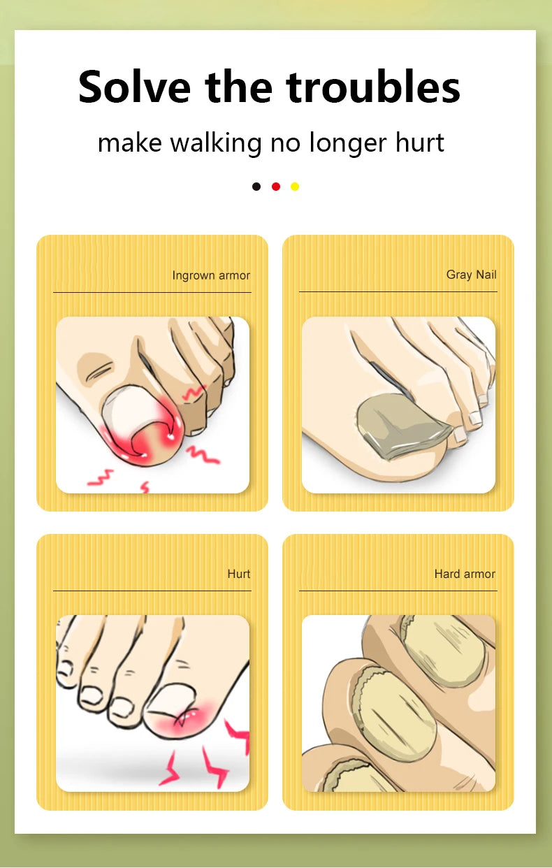 Precision Ingrown Nail Clippers