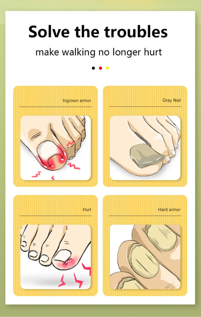 Precision Ingrown Nail Clippers